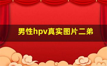 男性hpv真实图片二弟