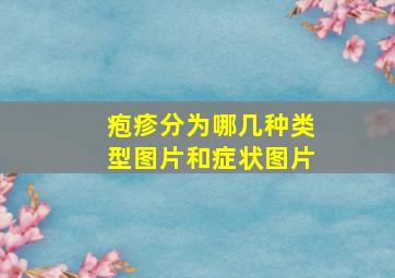 疱疹分为哪几种类型图片和症状图片