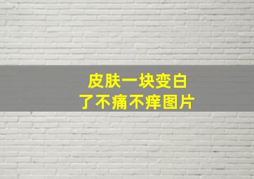 皮肤一块变白了不痛不痒图片