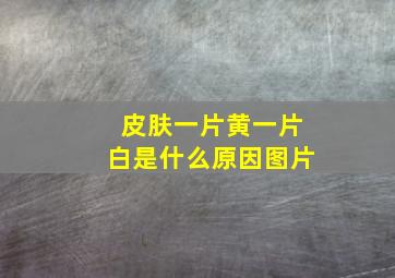 皮肤一片黄一片白是什么原因图片