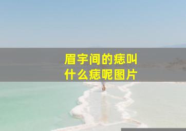 眉宇间的痣叫什么痣呢图片