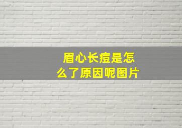 眉心长痘是怎么了原因呢图片