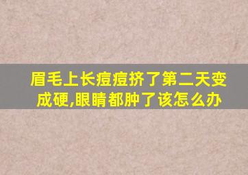 眉毛上长痘痘挤了第二天变成硬,眼睛都肿了该怎么办