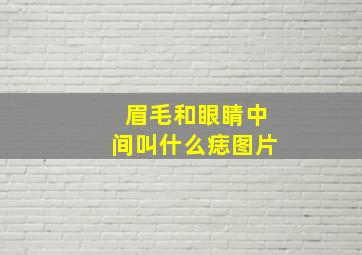 眉毛和眼睛中间叫什么痣图片