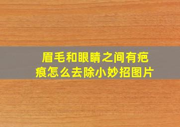 眉毛和眼睛之间有疤痕怎么去除小妙招图片