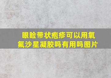 眼睑带状疱疹可以用氧氟沙星凝胶吗有用吗图片