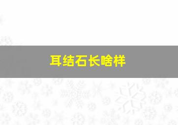 耳结石长啥样