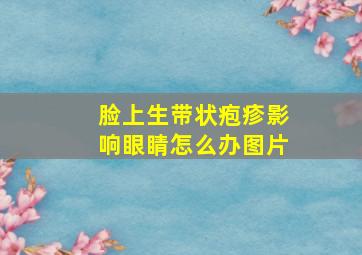 脸上生带状疱疹影响眼睛怎么办图片