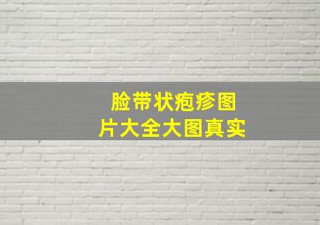 脸带状疱疹图片大全大图真实