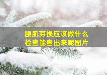 腰肌劳损应该做什么检查能查出来呢图片