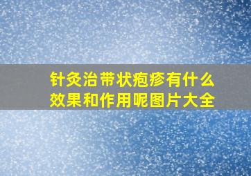 针灸治带状疱疹有什么效果和作用呢图片大全