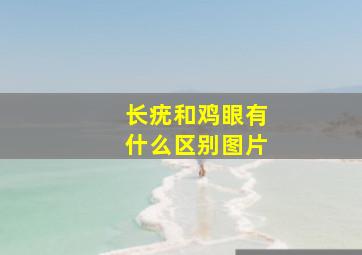 长疣和鸡眼有什么区别图片