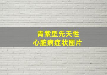 青紫型先天性心脏病症状图片