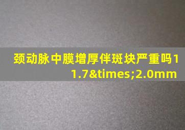 颈动脉中膜增厚伴斑块严重吗11.7×2.0mm