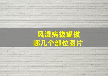 风湿病拔罐拔哪几个部位图片