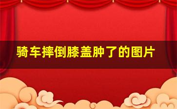 骑车摔倒膝盖肿了的图片