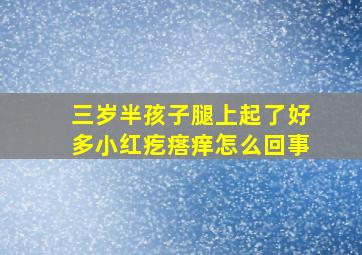 三岁半孩子腿上起了好多小红疙瘩痒怎么回事