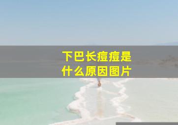 下巴长痘痘是什么原因图片