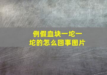 例假血块一坨一坨的怎么回事图片