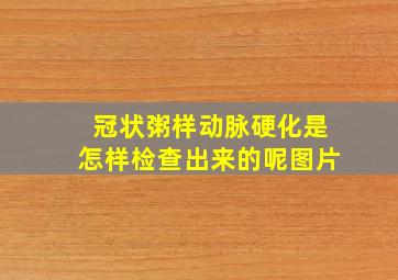 冠状粥样动脉硬化是怎样检查出来的呢图片