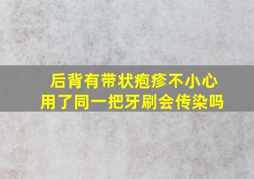 后背有带状疱疹不小心用了同一把牙刷会传染吗