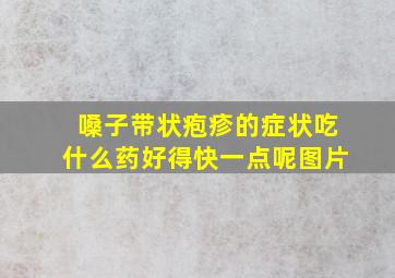 嗓子带状疱疹的症状吃什么药好得快一点呢图片