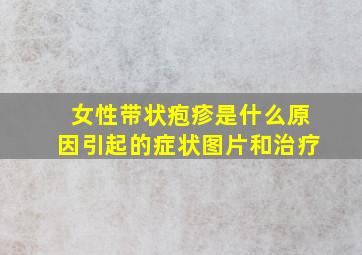 女性带状疱疹是什么原因引起的症状图片和治疗