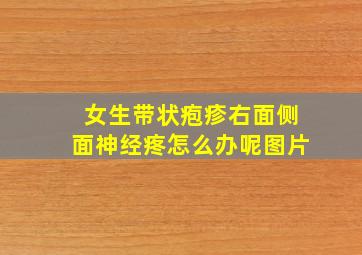 女生带状疱疹右面侧面神经疼怎么办呢图片