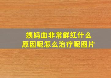 姨妈血非常鲜红什么原因呢怎么治疗呢图片