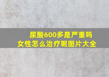 尿酸600多是严重吗女性怎么治疗呢图片大全