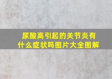 尿酸高引起的关节炎有什么症状吗图片大全图解