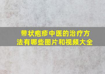 带状疱疹中医的治疗方法有哪些图片和视频大全