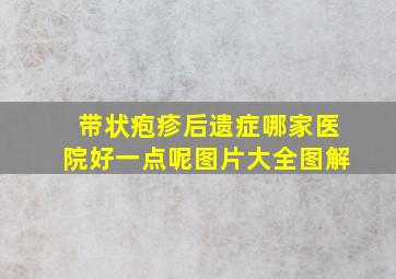 带状疱疹后遗症哪家医院好一点呢图片大全图解