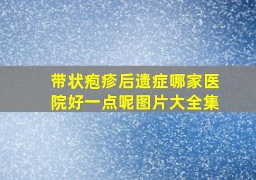 带状疱疹后遗症哪家医院好一点呢图片大全集