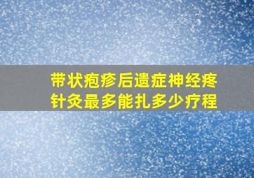 带状疱疹后遗症神经疼针灸最多能扎多少疗程