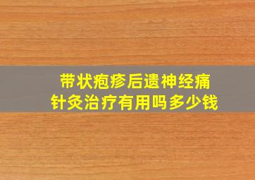 带状疱疹后遗神经痛针灸治疗有用吗多少钱