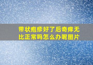 带状疱疹好了后奇痒无比正常吗怎么办呢图片