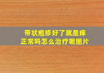 带状疱疹好了就是痒正常吗怎么治疗呢图片