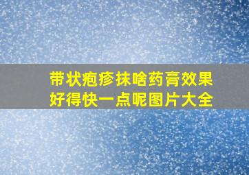 带状疱疹抹啥药膏效果好得快一点呢图片大全