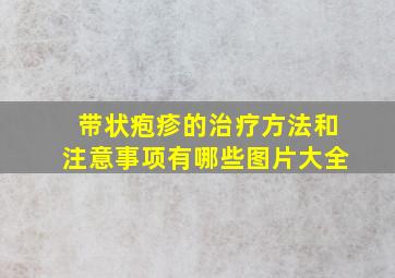 带状疱疹的治疗方法和注意事项有哪些图片大全