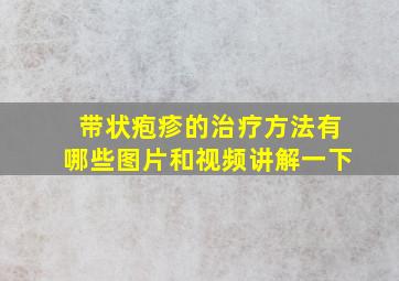 带状疱疹的治疗方法有哪些图片和视频讲解一下