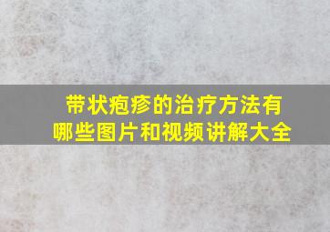 带状疱疹的治疗方法有哪些图片和视频讲解大全