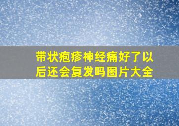 带状疱疹神经痛好了以后还会复发吗图片大全