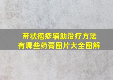 带状疱疹辅助治疗方法有哪些药膏图片大全图解