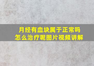 月经有血块属于正常吗怎么治疗呢图片视频讲解