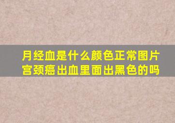 月经血是什么颜色正常图片宫颈癌出血里面出黑色的吗