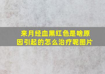 来月经血黑红色是啥原因引起的怎么治疗呢图片