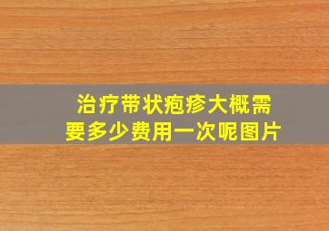 治疗带状疱疹大概需要多少费用一次呢图片