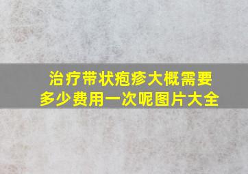 治疗带状疱疹大概需要多少费用一次呢图片大全