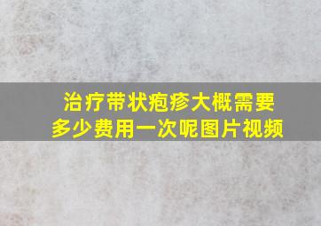 治疗带状疱疹大概需要多少费用一次呢图片视频